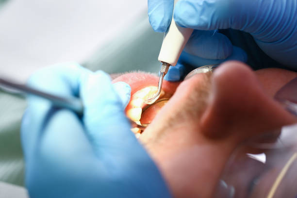Best Pediatric Emergency Dentist in Osceola, IA