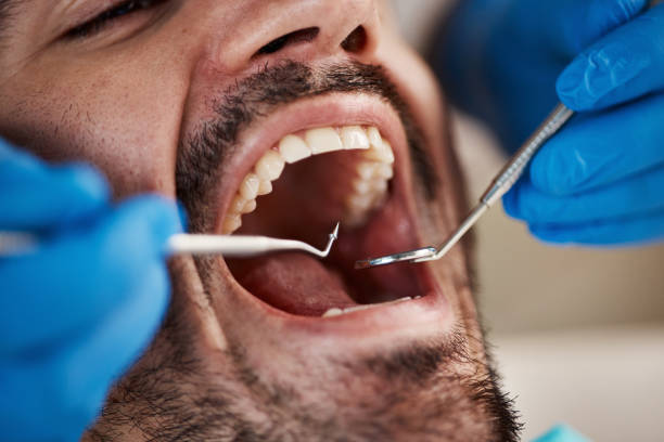 Best Pediatric Emergency Dentist in Osceola, IA